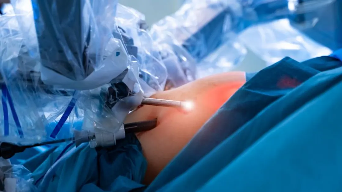 Cirurgia Robótica no Tratamento de Cânceres de Difícil Acesso · imagem ilustrativa