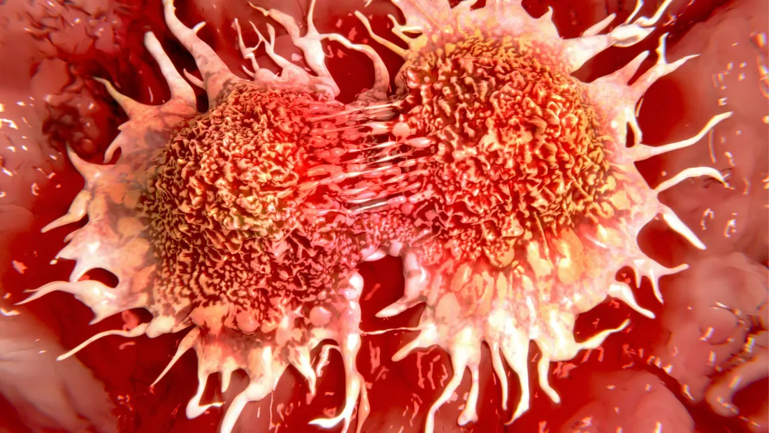 Síndrome da Lise Tumoral: O Que É, Causas, Riscos e Como Prevenir · imagem ilustrativa