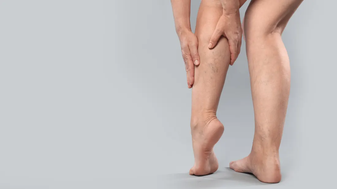 Trombose Venosa no Câncer: Causas, Sintomas e Prevenção · imagem ilustrativa