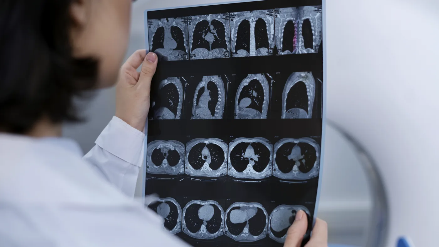 Médico analisando cortes de tomografia computadorizada · imagem ilustrativa