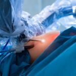 Cirurgia Robótica no Tratamento de Cânceres de Difícil Acesso | Dr. Michel Chebel