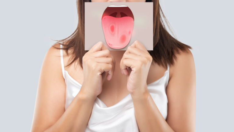 Mucosite Oral em Oncologia | Dr. Michel Chebel